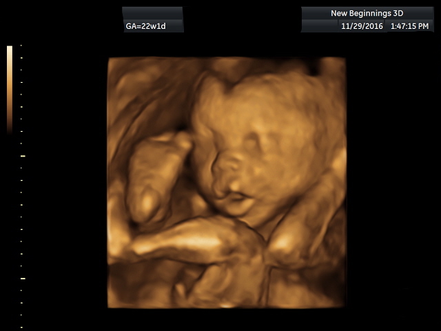 ultrasound1 (11)