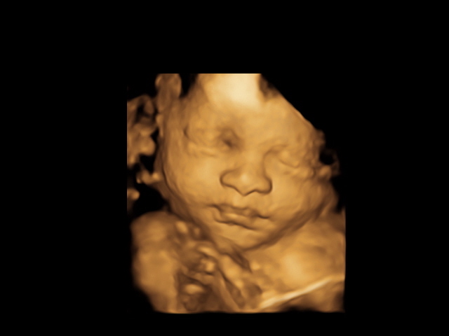 ultrasound of a baby