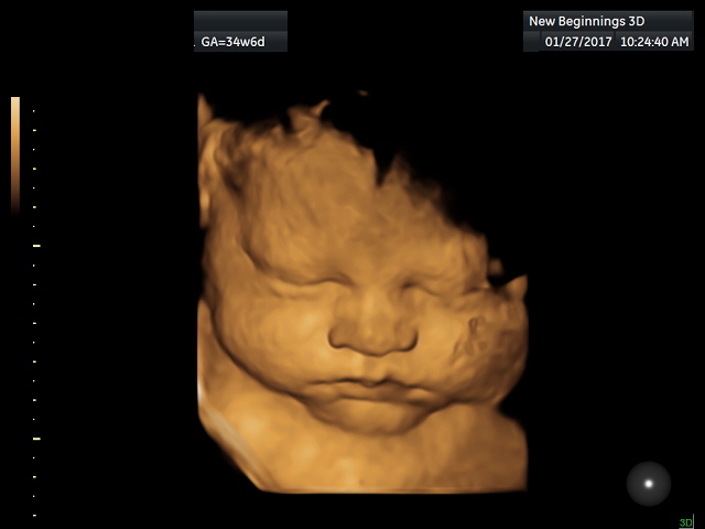 ultrasound1 (4)