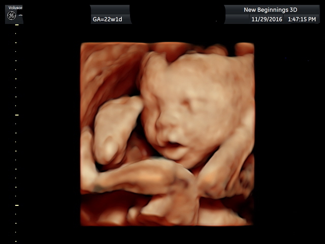 ultrasound1 (5)