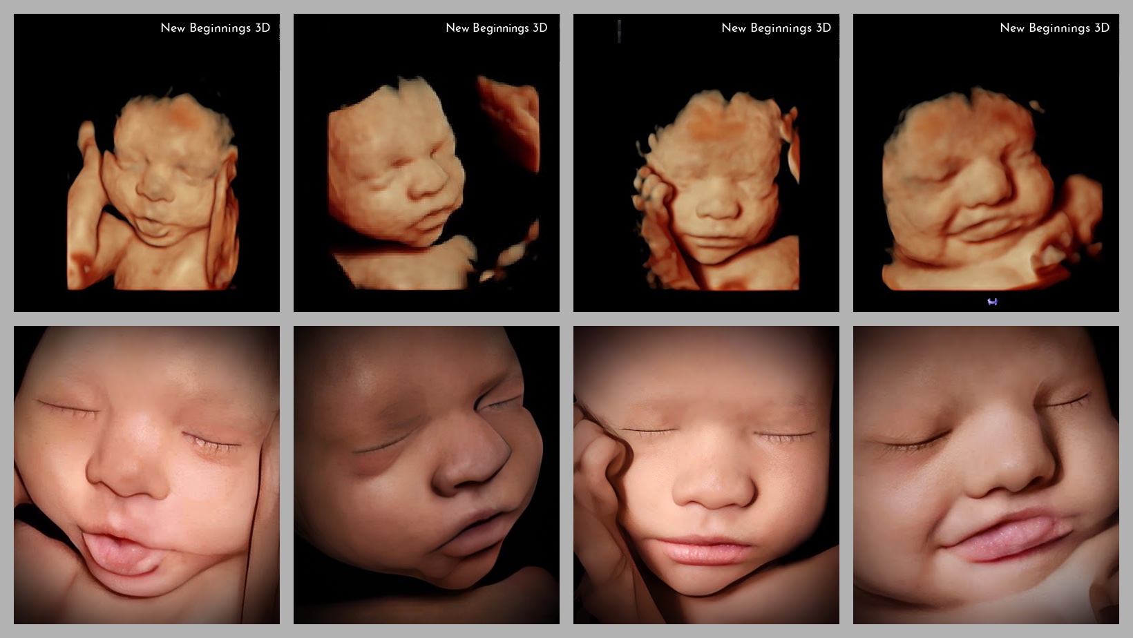 Home - New Beginnings 3D Ultrasound